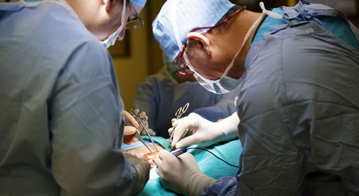 Operace se provádí v pokročilých stádiích chronické prostatitidy u mužů